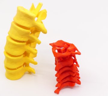Vertebras impresas en 3D Impresión 3D Médica