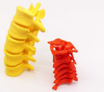Vertebras impresas en 3D Impresión 3D Médica